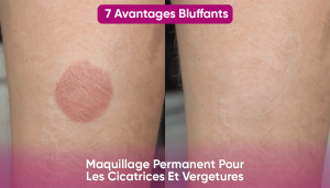 Maquillage Permanent Réparateur : 7 Raisons de l’Adopter pour les Cicatrices et Vergetures